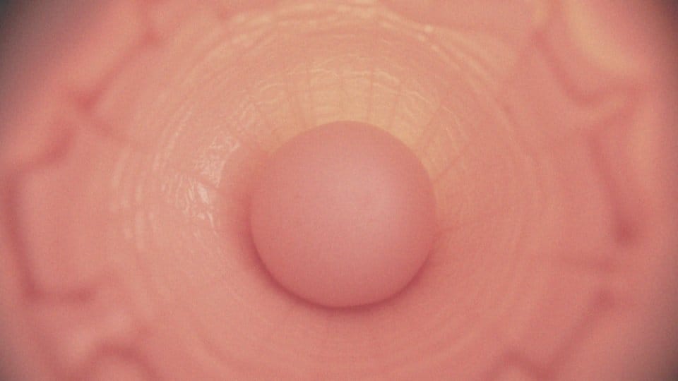 Co to jest zmiana podśluzówkowa? Kluczowe informacje i diagnostyka